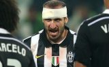 Juve v Barça : Chiellini forfait