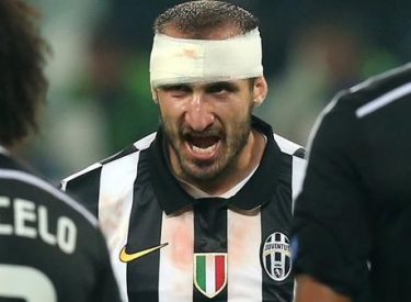 Juve v Barça : Chiellini forfait